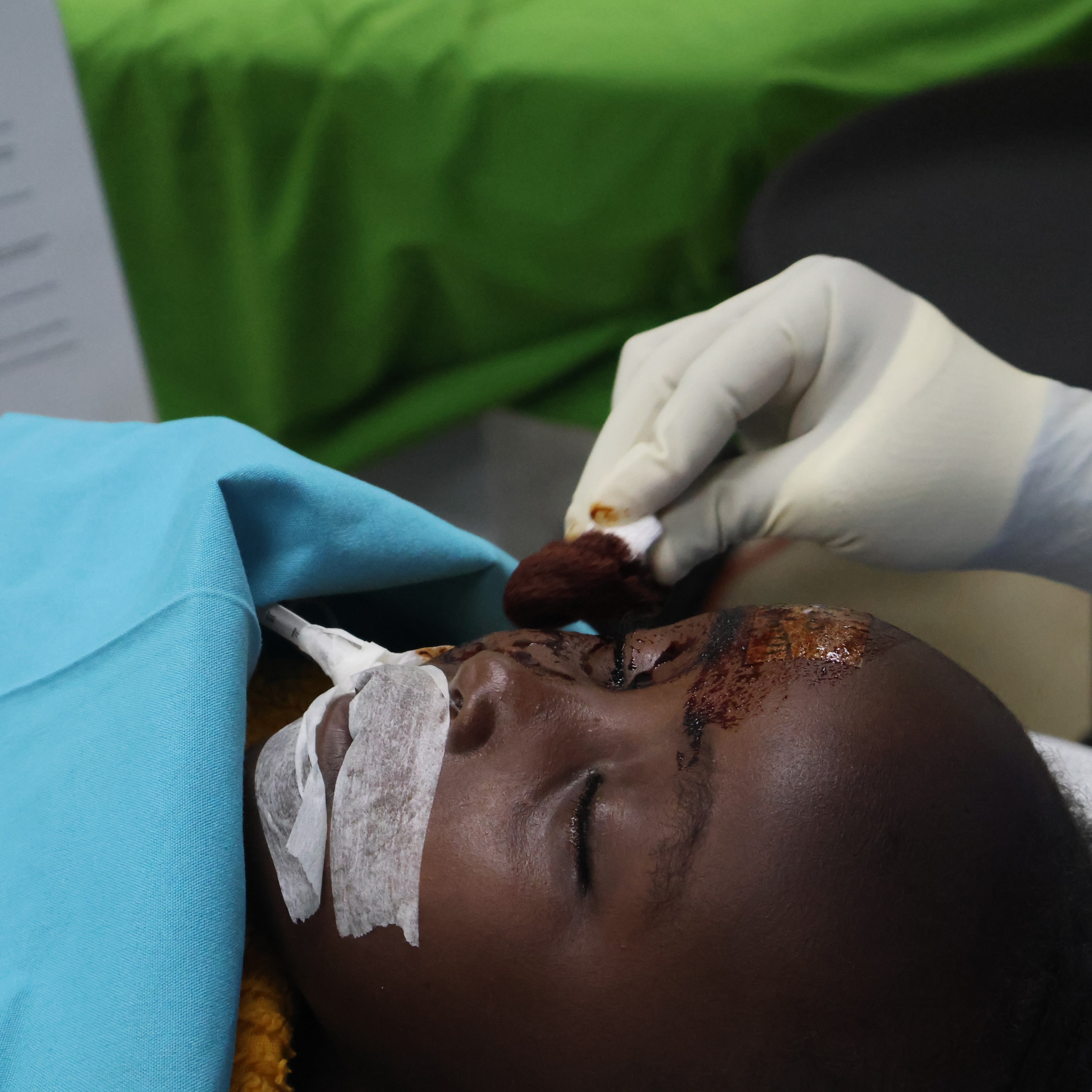 WECA Kenya Cataract Eye Recovery Surgery Support